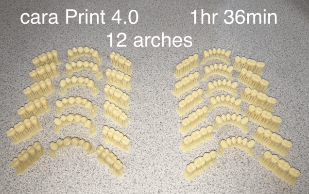 dima print Denture Teeth Material - Silcox Dental Supply