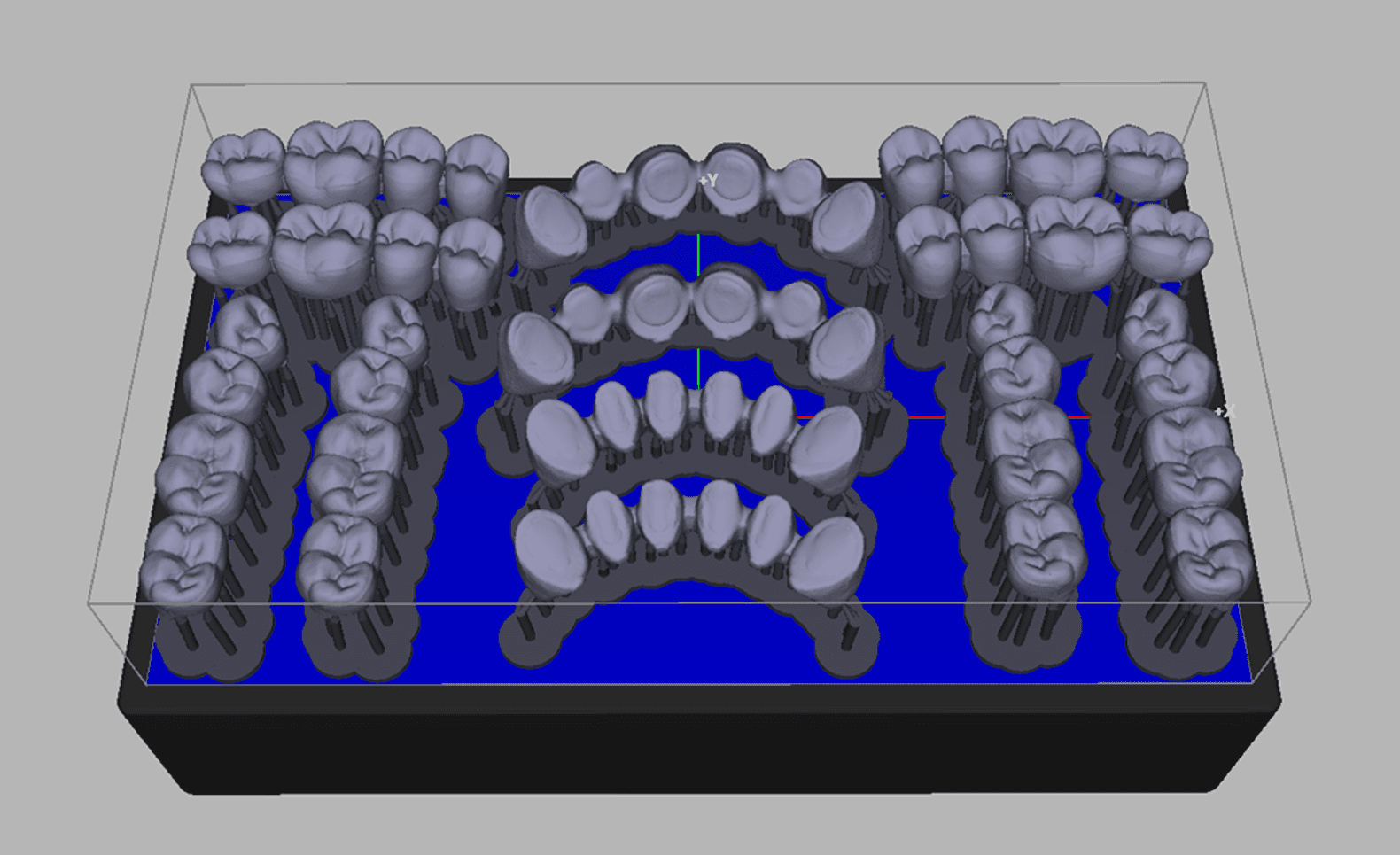 3d Printed Digital Dentures Silcox Dental Supply